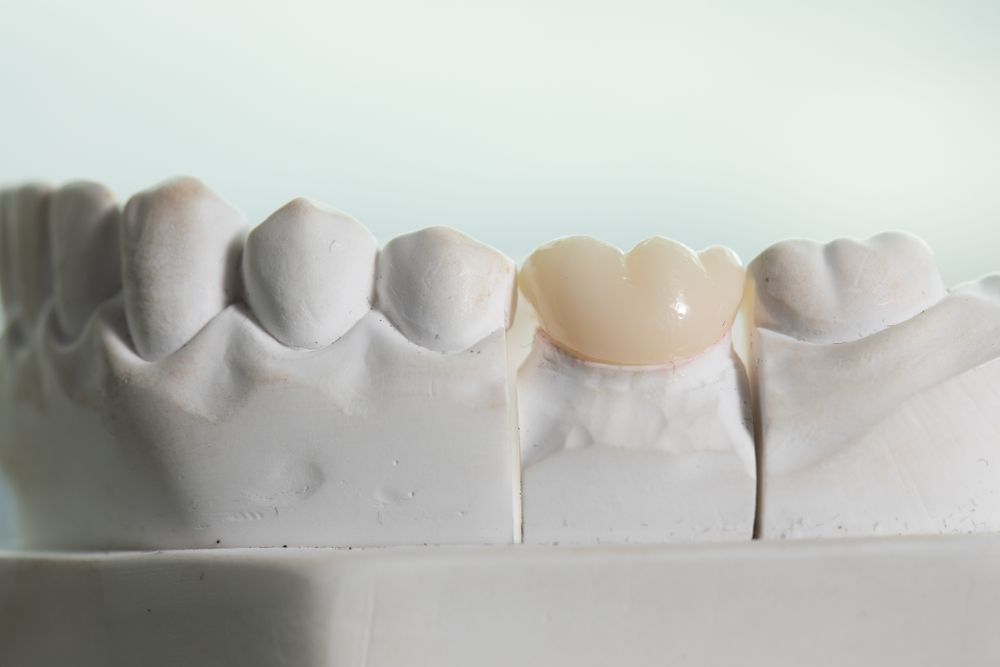 dental crown procedure